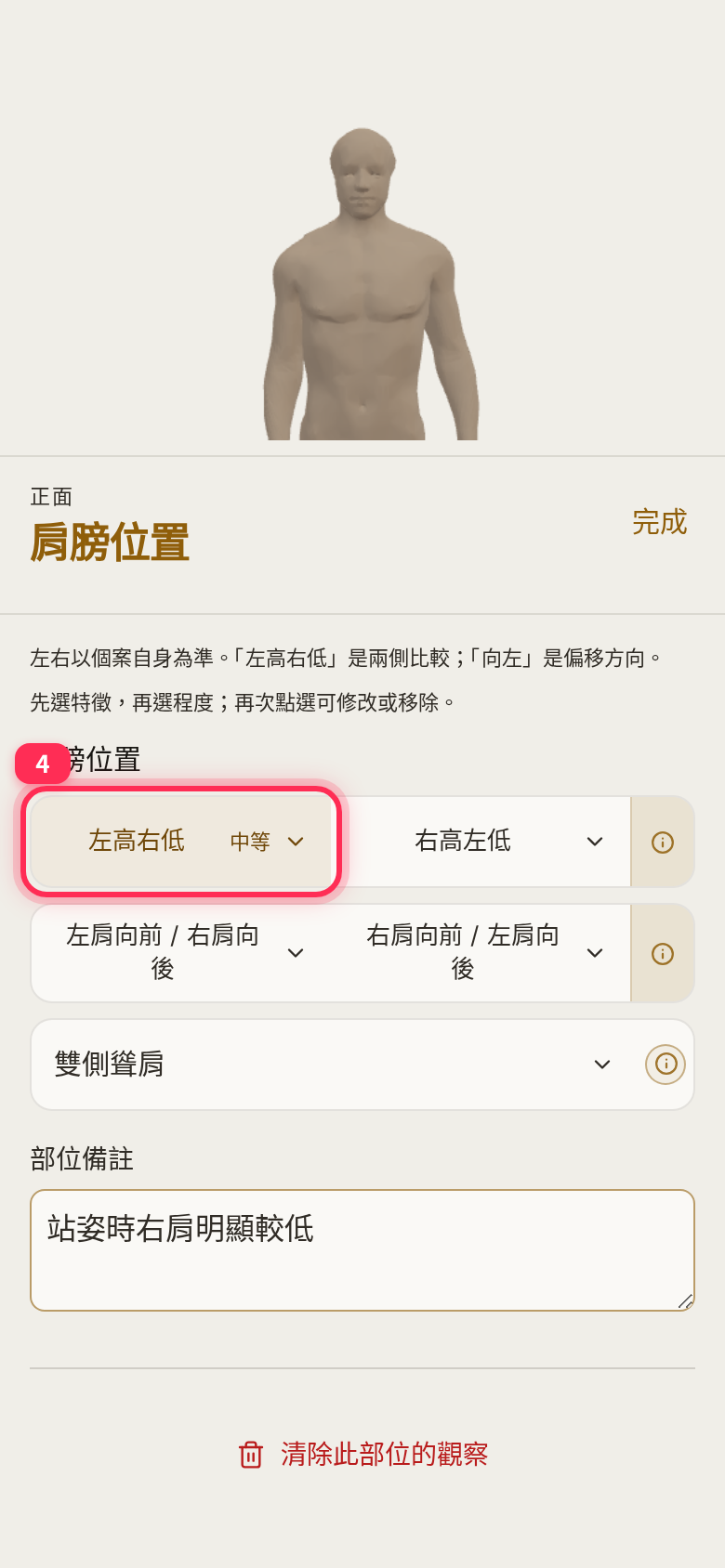 「左高右低・中等」已選取,下方填了部位備註,並有「清除此部位的觀察」