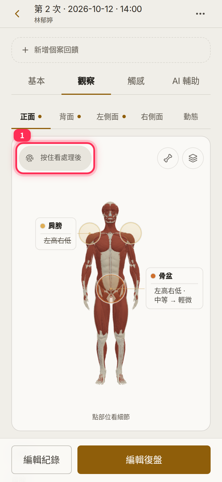 已儲存紀錄「觀察」分頁人形圖左上角的「按住看處理後」